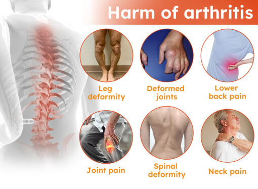 Fivfivgo™ Arthritis Cream (Neck & Back & Knee Relief)