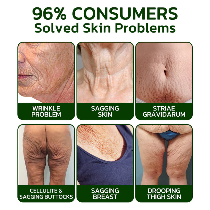 Fivfivgo™ Avocado Straffendes und Falten reduzierendes Körperlotion-Peeling (🇨🇦CDA empfohlen)