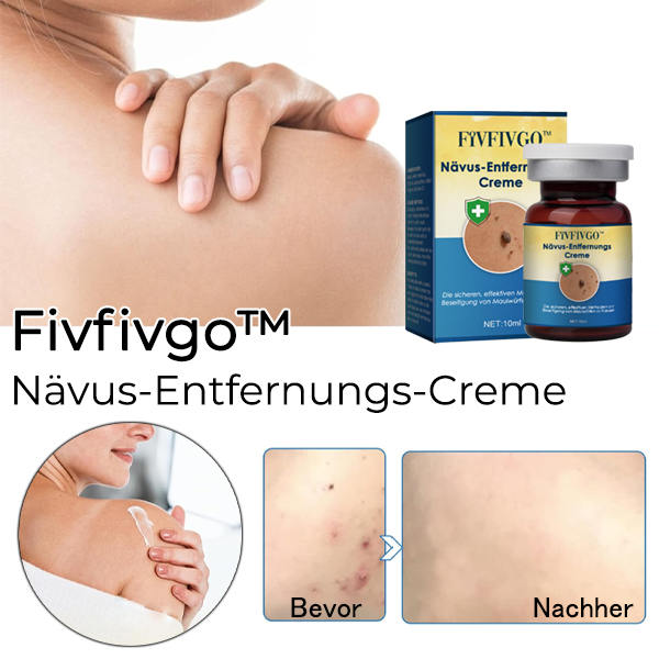 Fivfivgo™ Nävus-Entfernungs-Creme