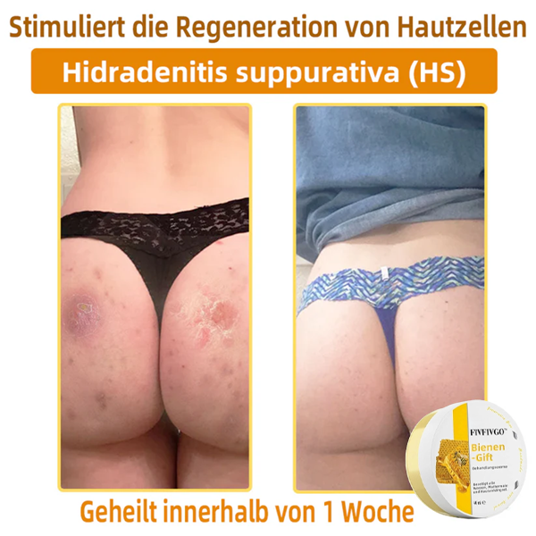Fivfivgo™ Bienengift-Therapie-Creme