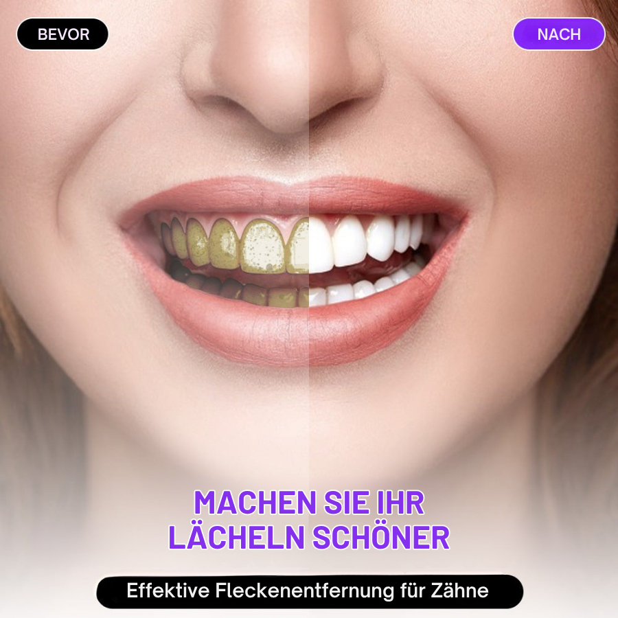 Fivfivgo® Farb Korrektor Serum | Klinisch erwiesen, dass es Flecken sanft entfernt, die Zähne aufhellt und den natürlichen Glanz in nur 3 Tagen wiederherstellt - sicher für empfindliche Zähne und Zahnschmelz