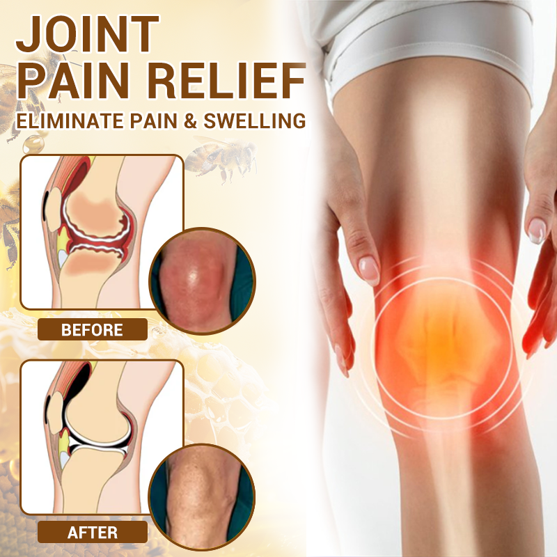 Fivfivgo™ Bee Venom Arthritis Therapy Cream (Specially for older adults & AAOS recommends)🔥
