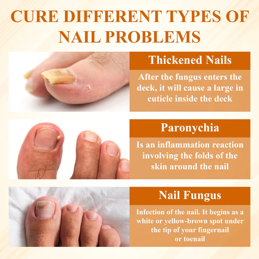 Fivfivgo® Fungiclear Bee Therapy Nail Spray