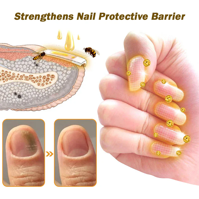Fivfivgo™ Nagelpilz Bienengift Behandlung Serum