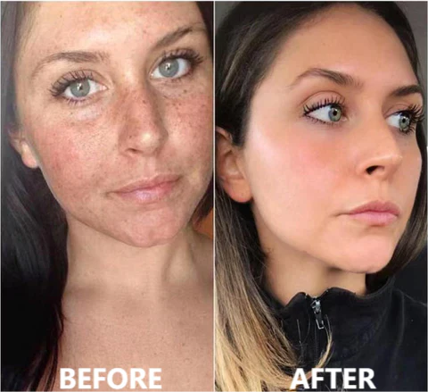 Fivfivgo™ Collagen Boost Anti-Aging Serum For Remove 97% Deep Wrinkles & Dark Spots