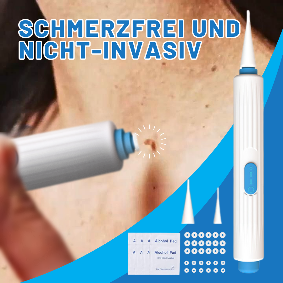 Fivfivgo™ Zu Hause Haut Tag Einfädeln Stift