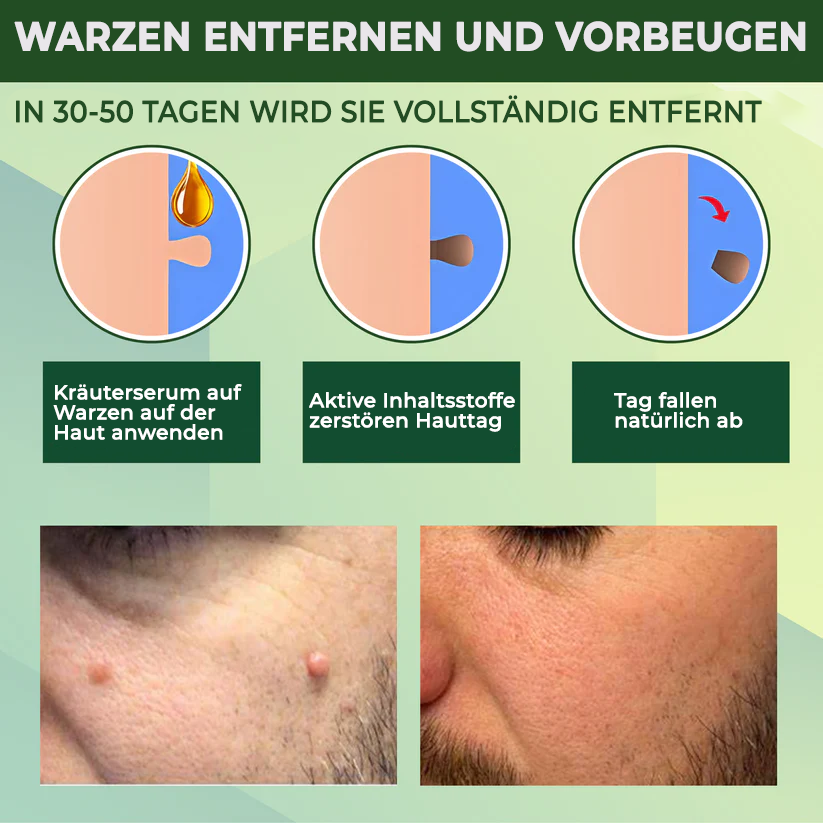 Fivfivgo® Reedle Shot 100 Tag & Spot Zielscheibe Fortgeschrittenes Serum