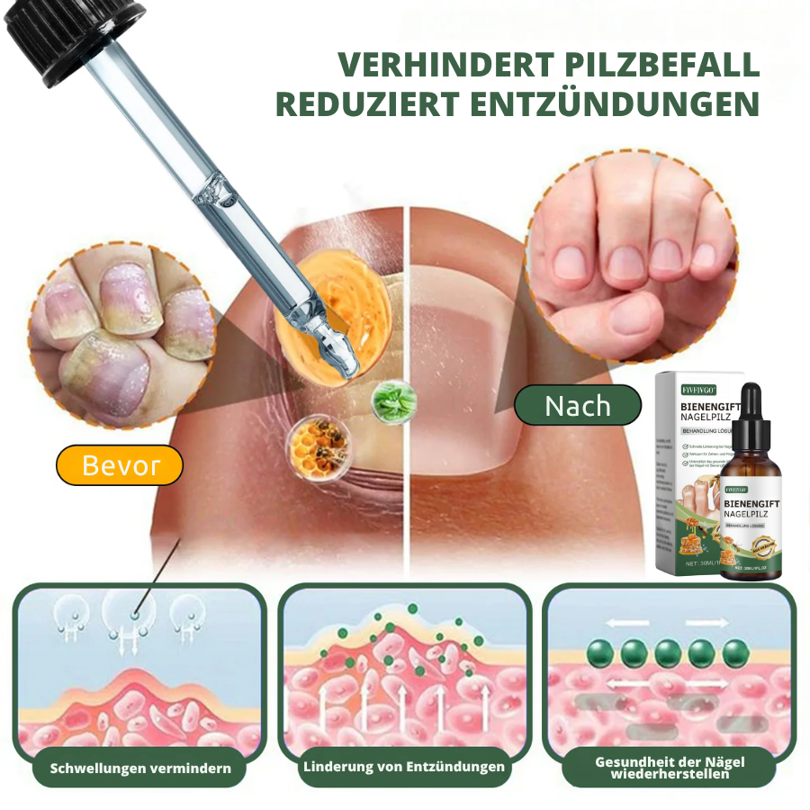 Fivfivgo® Bienengift Nagelpilz Behandlung Lösung: Natürliche Formel für die Gesundheit von Zehennägeln und Fingernägeln