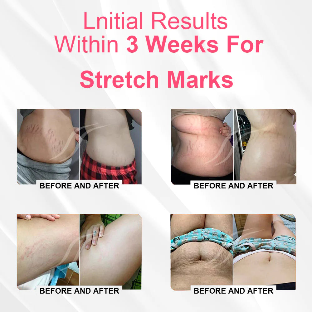 Fivfivgo™ Magnetic Nano Ion Fat Burning Belly Controlling Detoxifying Shaper