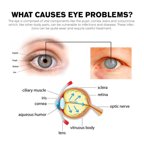 Fivfivgo™ Treatment Eye Problems Solution Drops