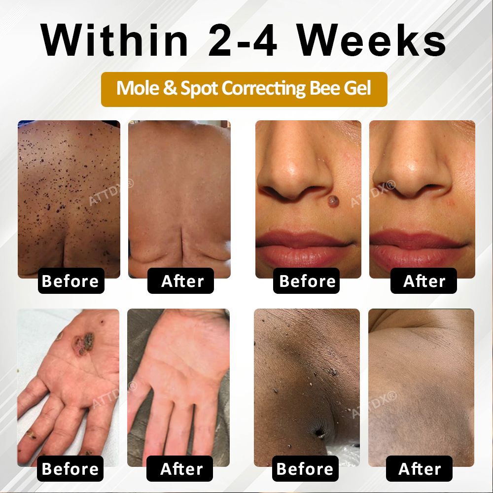 Fivfivgo® Advanced Mole & Spot Correcting Bee Gel
