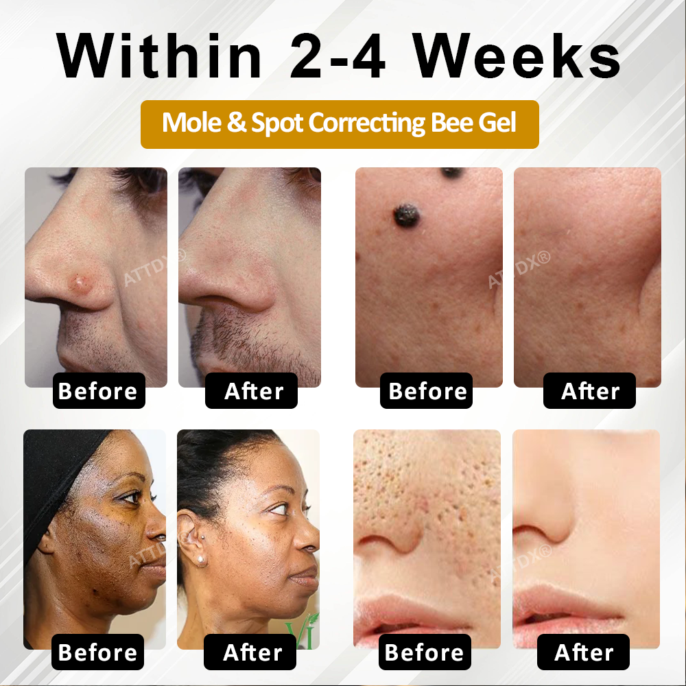 Fivfivgo® Advanced Mole & Spot Correcting Bee Gel