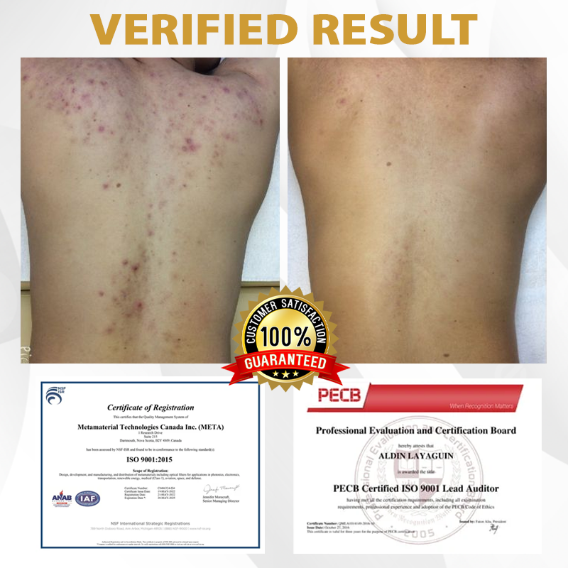 Fivfivgo® Advanced Mole & Spot Correcting Bee Gel