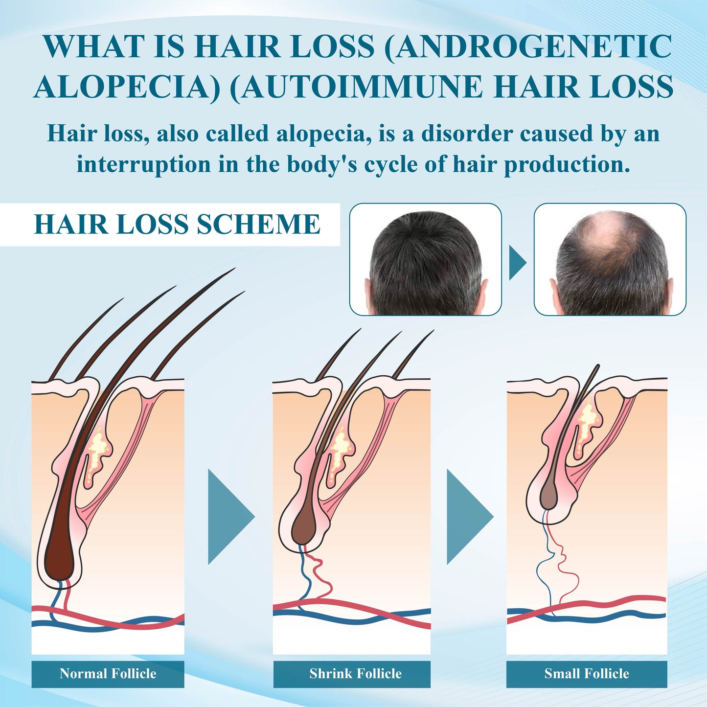 Fivfivgo™ Alopecia Recovery Hair Regrowth Cream