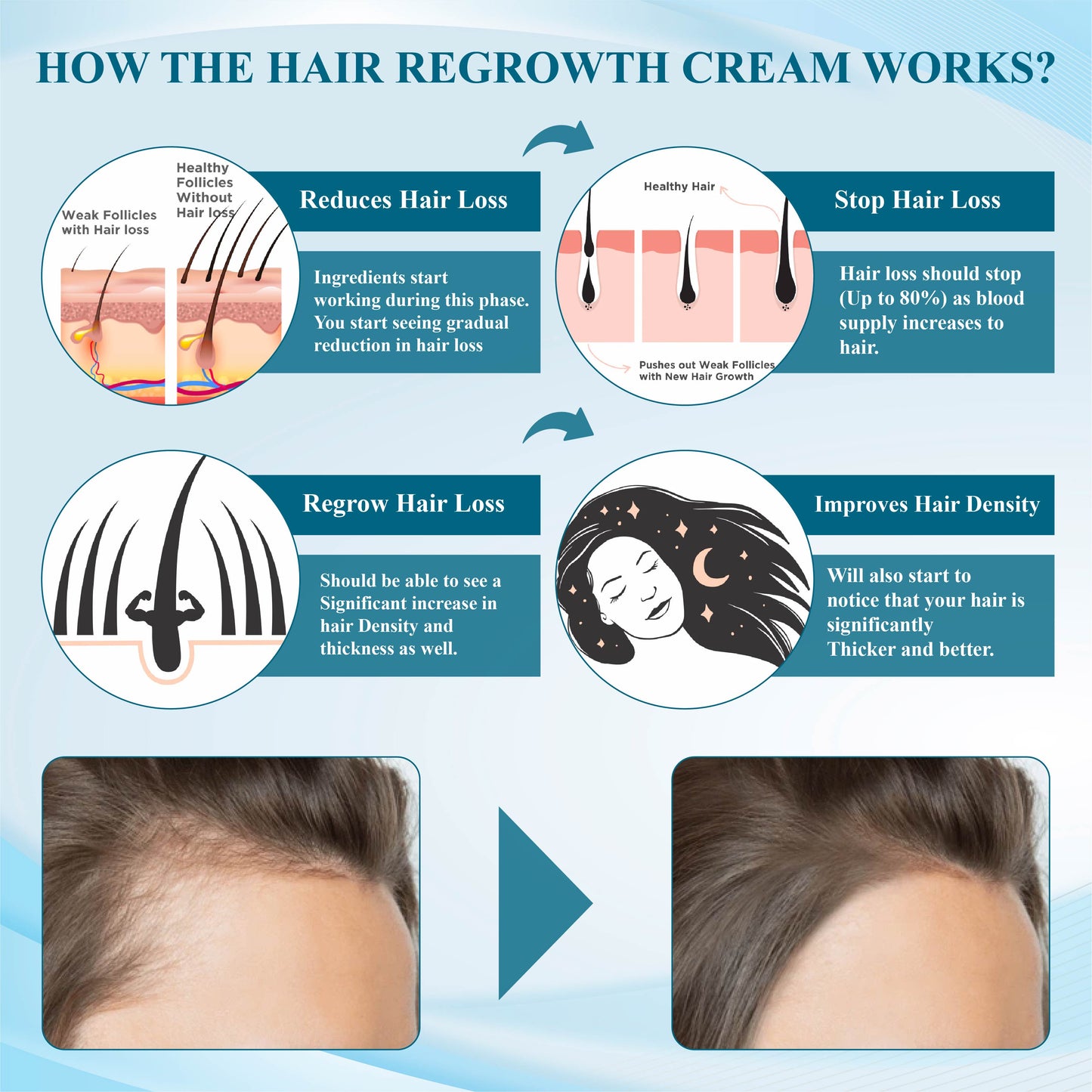 Fivfivgo™ Alopecia Recovery Hair Regrowth Cream