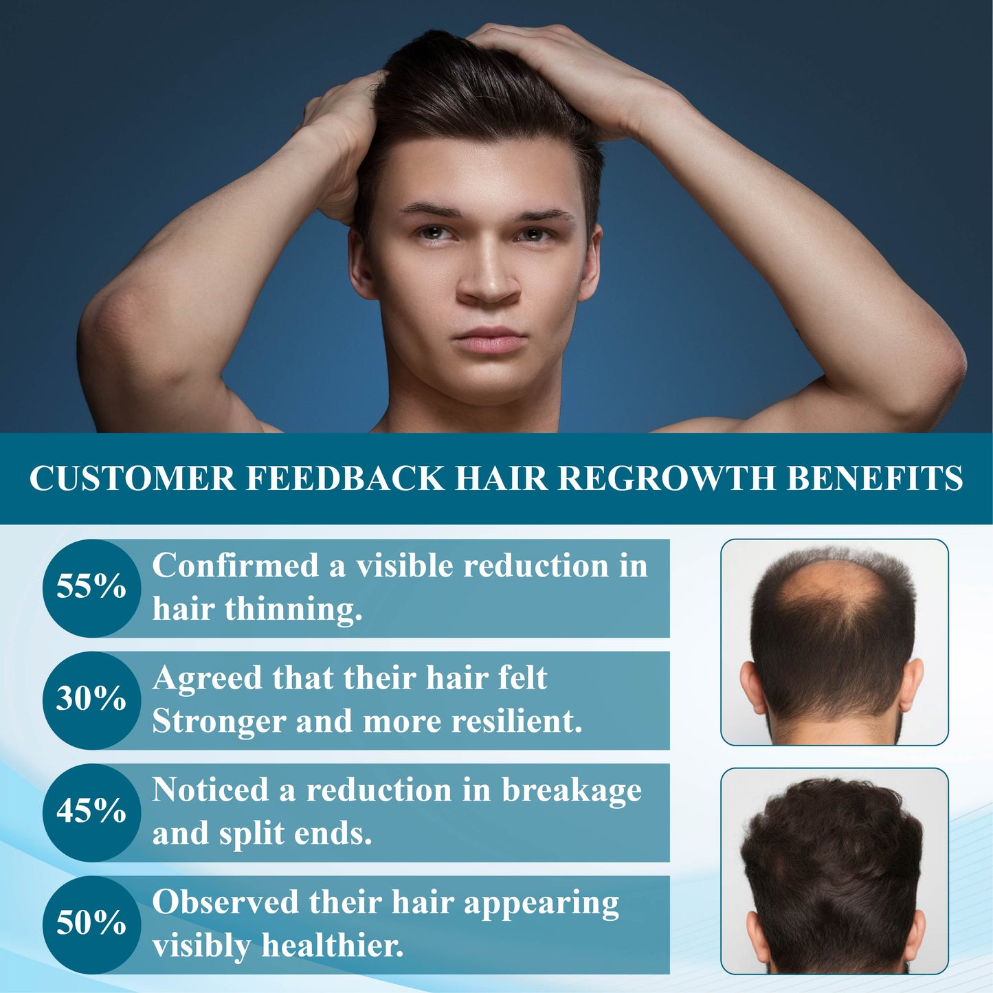 Fivfivgo™ Alopecia Recovery Hair Regrowth Cream