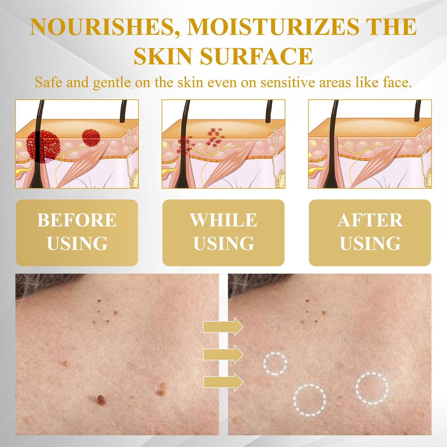 Fivfivgo® Advanced Mole & Spot Correcting Bee Gel