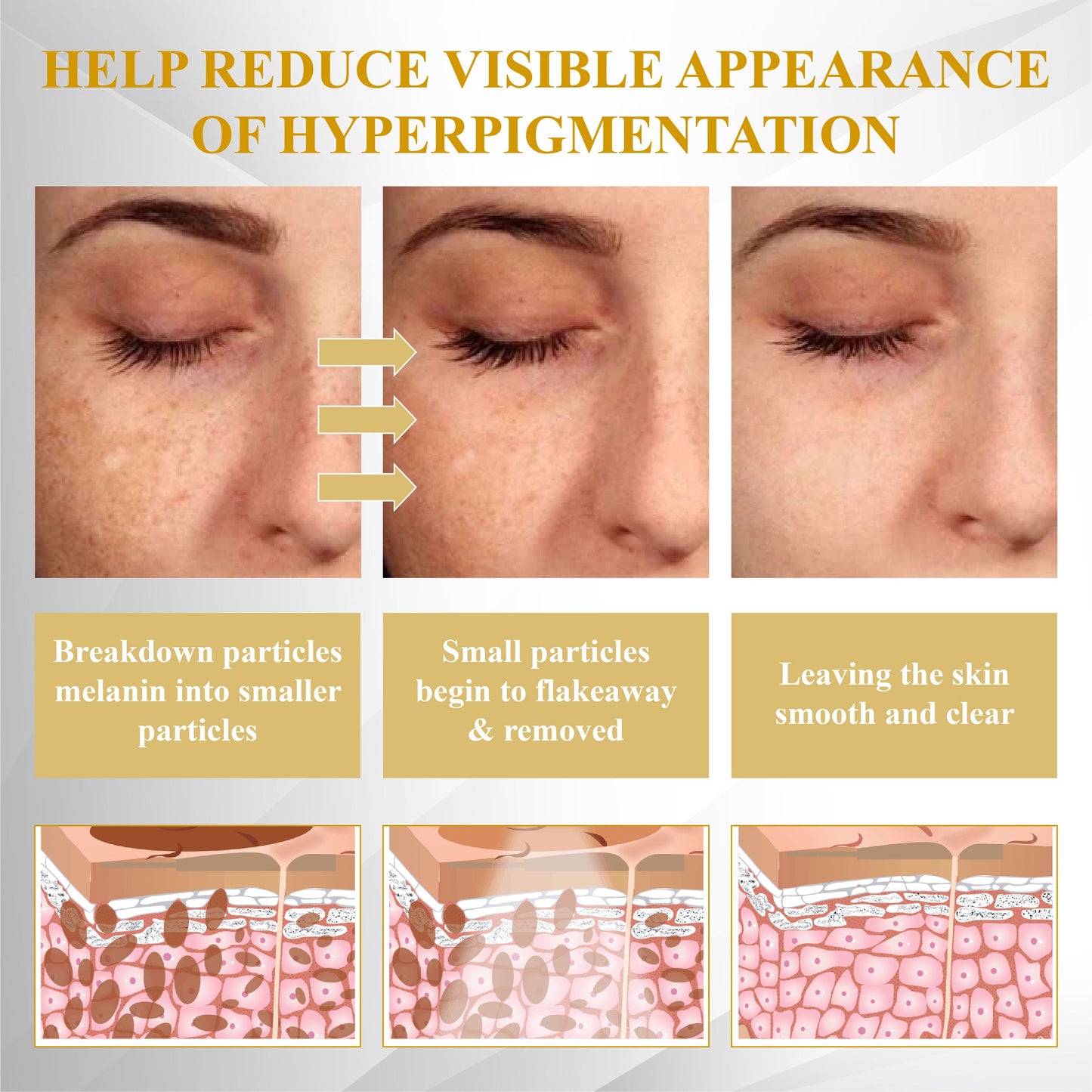 Fivfivgo® Advanced Mole & Spot Correcting Bee Gel