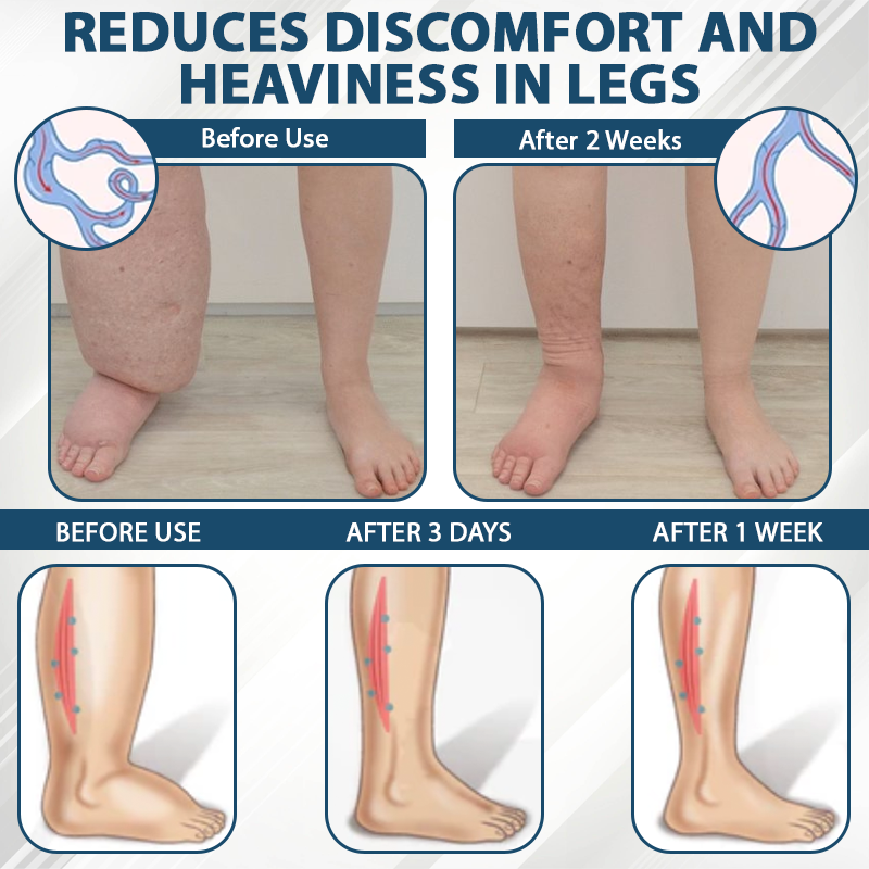 Fivfivgo® Black Cumin Edema Soothing Herbal Cream