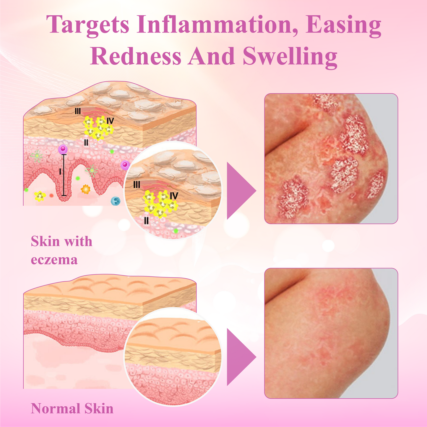 Fivfivgo™ Derma Relief Skin Therapy Cream