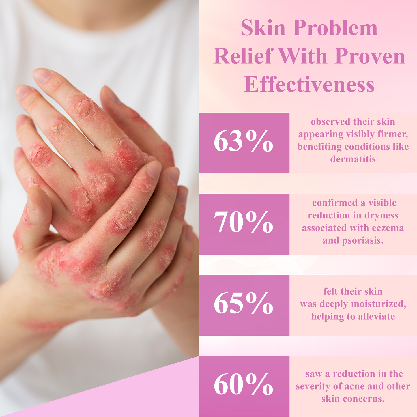 Fivfivgo™ Derma Relief Skin Therapy Cream