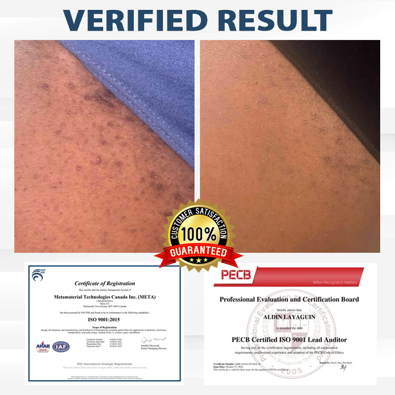 Fivfivgo® LicorRelief Man Genital Antifungal Cream