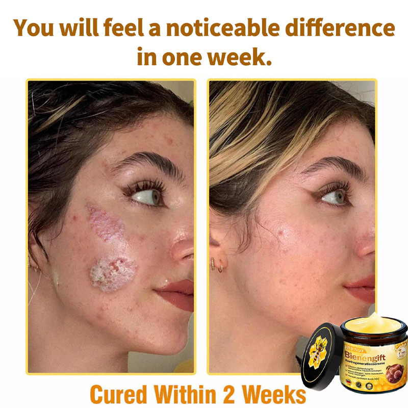 Fivfivgo™ Bee Venom Skin Regeneration Cream