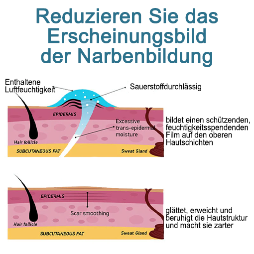 Fivfivgo™ Erweiterte Narbenentfernung Gel