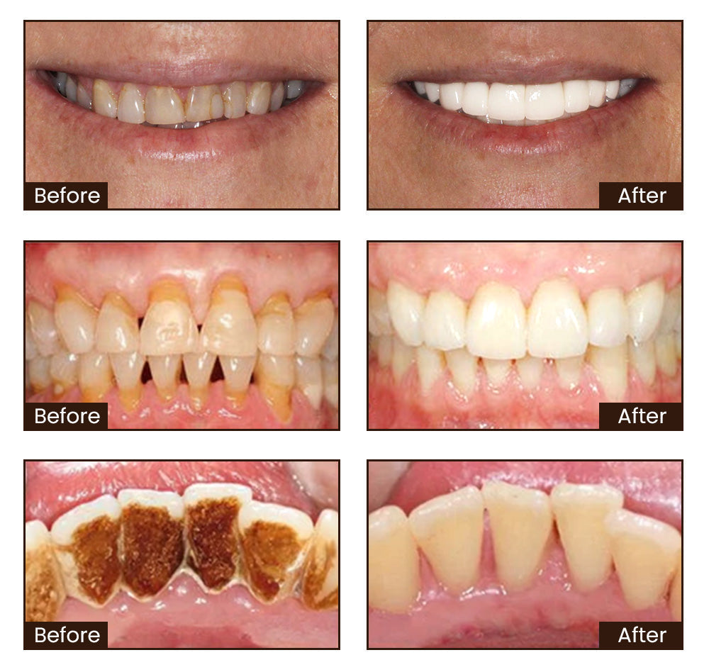 Fivfivgo™ Niacinamide Dentifrice Blanchissant