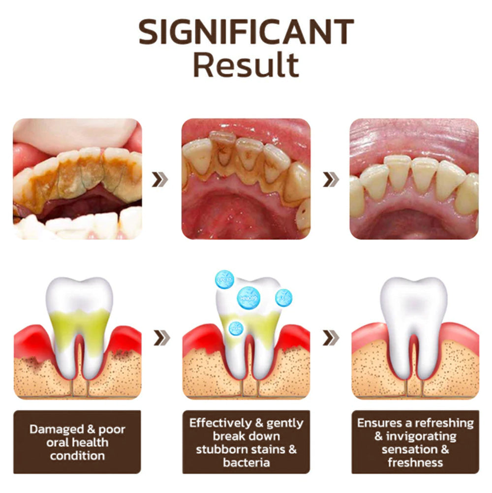 Fivfivgo™ Niacinamide Dentifrice Blanchissant