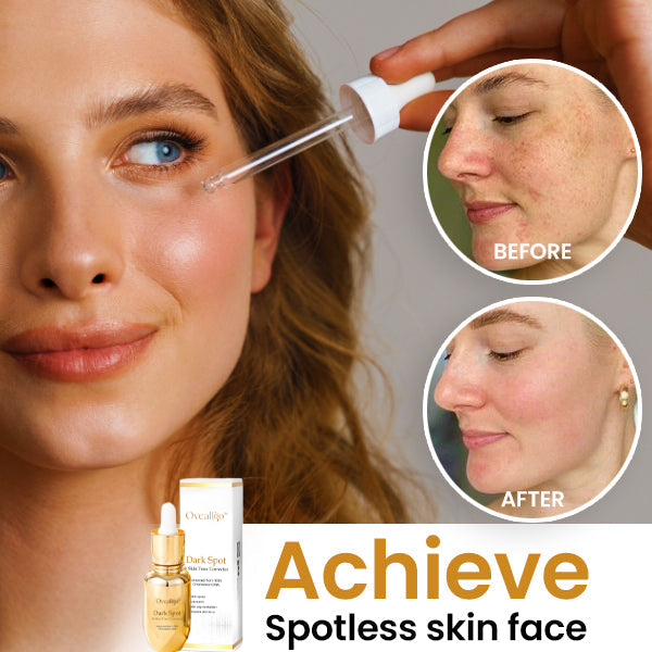 Oveallgo™ Dark Spot and Skin Tone Corrector