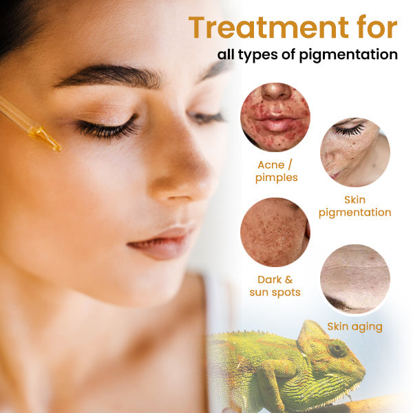 Oveallgo™ Dark Spot and Skin Tone Corrector