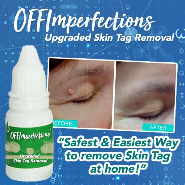 OFFImperfections™ Upgraded Skin Tag Removal