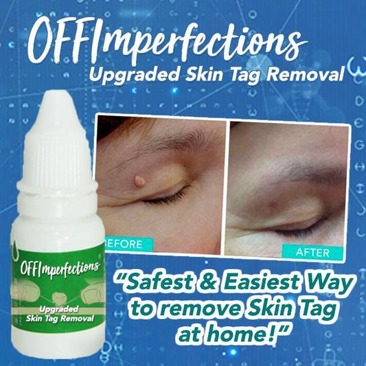 OFFImperfections™ Upgraded Skin Tag Removal