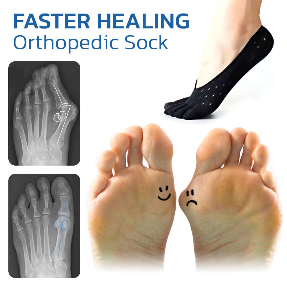 Fivfivgo™ Orthopédie Bunion Secours Chaussettes
