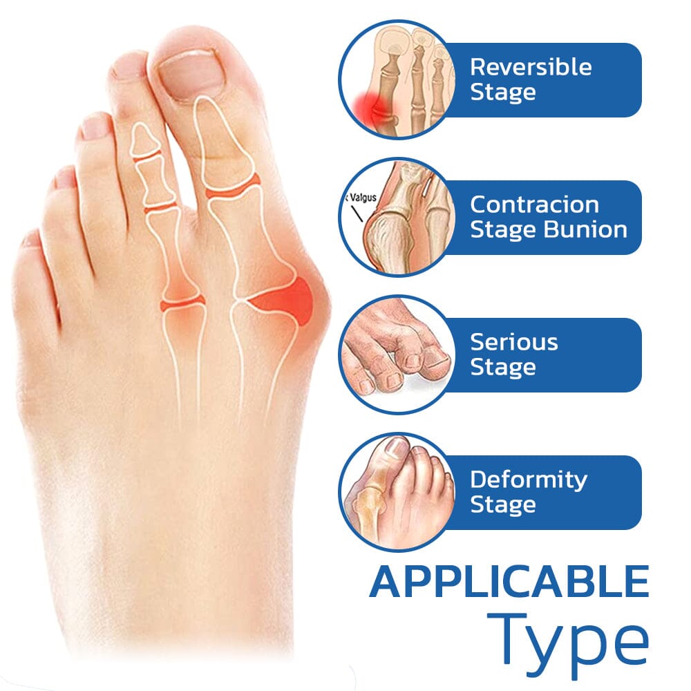 Fivfivgo™ Orthopédie Bunion Secours Chaussettes