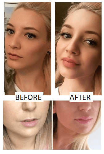 24k Gold Anti-Aging Lip Oil