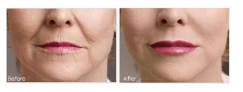 24k Gold Anti-Aging Lip Oil