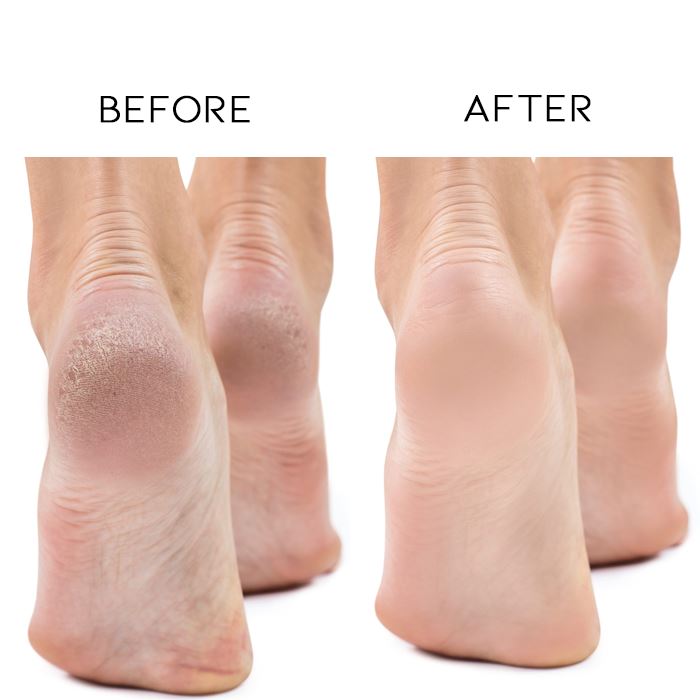 Lavender Baby Foot Mask Skin Care Every Day And Night 