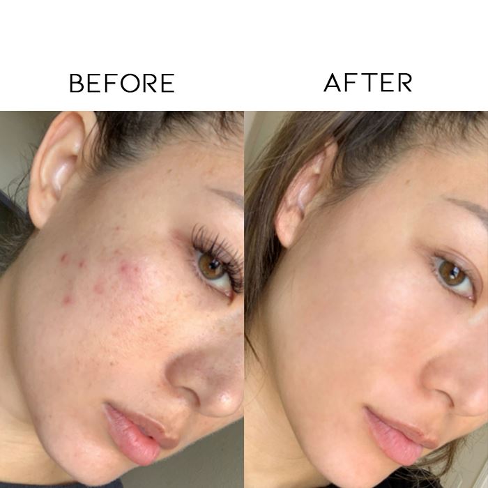 DeepClean Peel Off Mask Skin Care Every Day And Night 