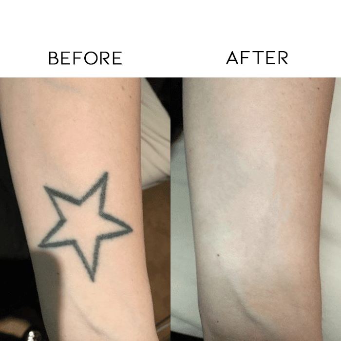 Waterproof Skin-like Full Coverage Sticking Sheet Personal Care Every Day And Night 