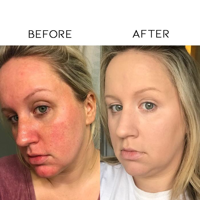 Cica Redness Reduce Instant Repair Cream Skin Care Every Day And Night 