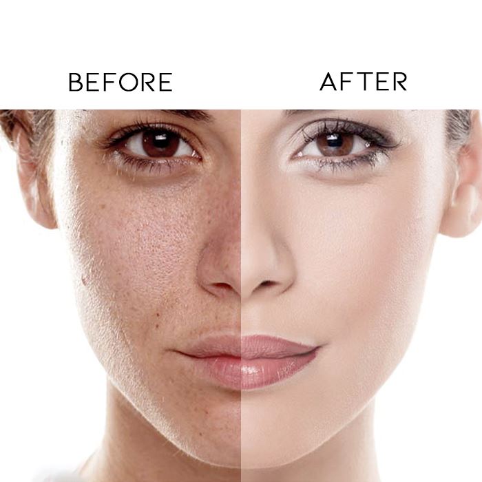 Intense Hyaluronic Acid Moisturizing Serum Skin Care Every Day And Night 