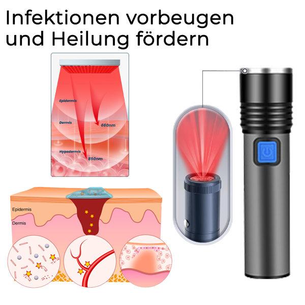 Fivfivgo™ Wund- und Geschwürheilungs-Infrarotstift