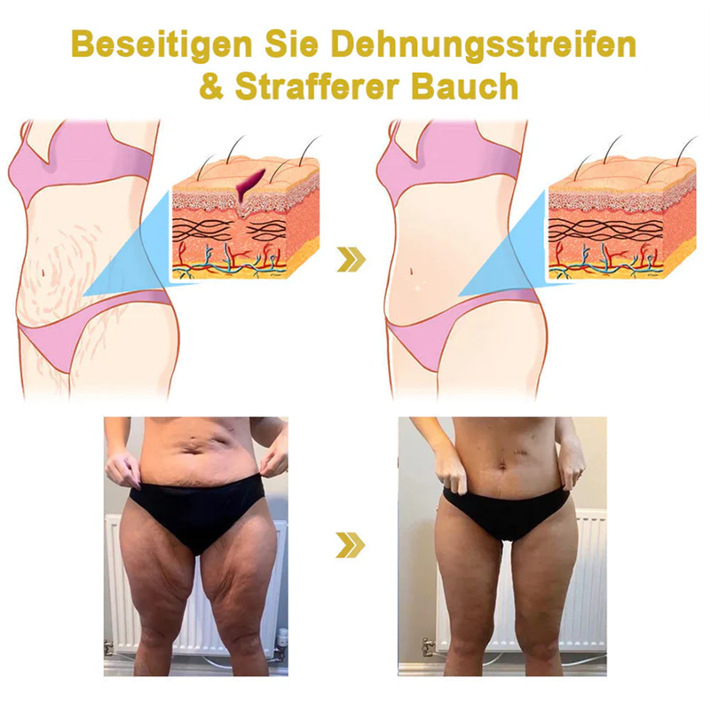2025 Readers' Choice Award-Gewinner 🥇Fivfivgo™ Straffende jugendlich revitalisierende Creme: Stellt die Elastizität der Haut wieder her