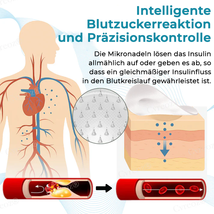 Cvreoz® InsuliNeedle Glukosekontrolle Microneedling-Pflaster