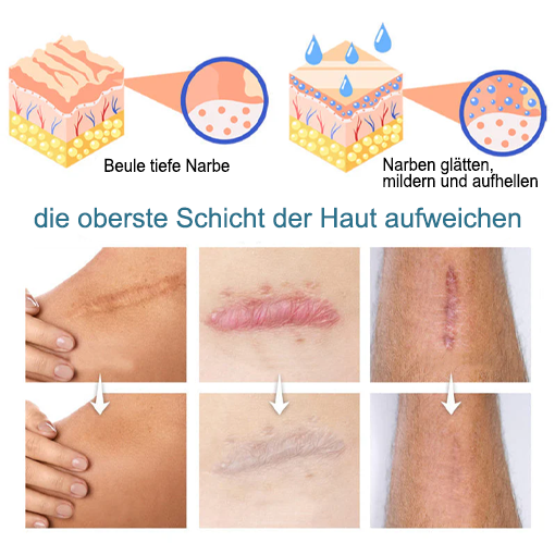 Fivfivgo™ Erweiterte Narbenentfernung Gel