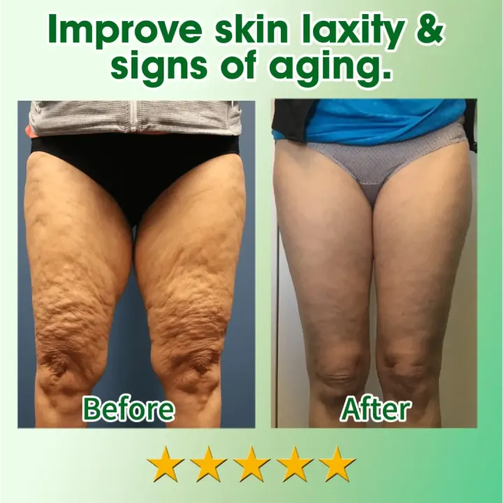 Fivfivgo™ 30 Herbal Firming Slimming & Detox Foot Bath Beads (Effective Treatment for High Blood Sugar and Arthritis)