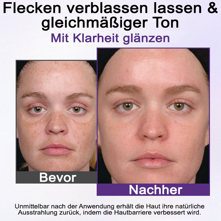 Fivfivgo® PigmentaX ProFade Anti-Hyperpigmentierungs Creme