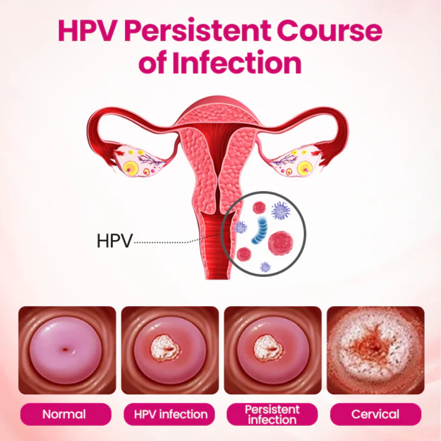 Fivfivgo® IntiDefend Anti-HPV Interferon Gel